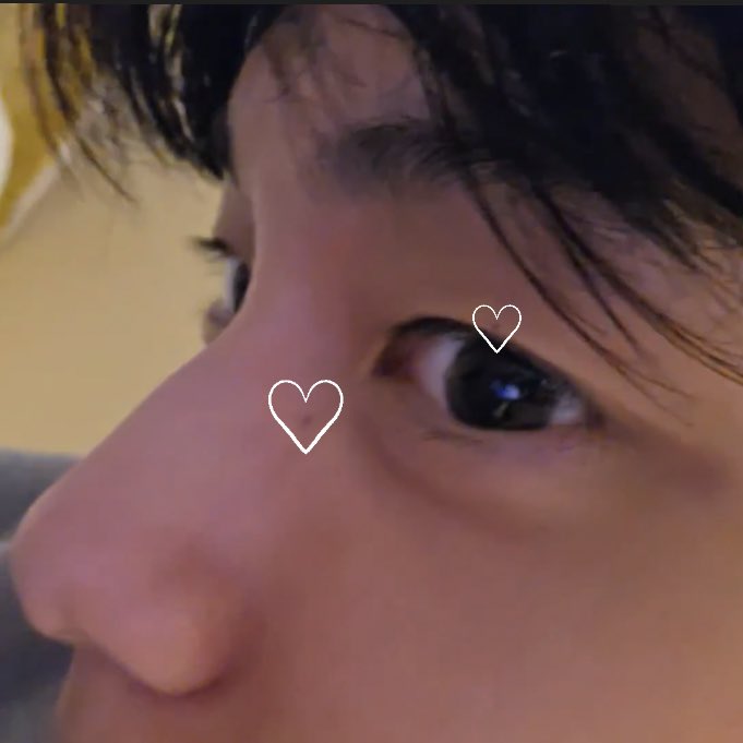 his pretty moles ♡