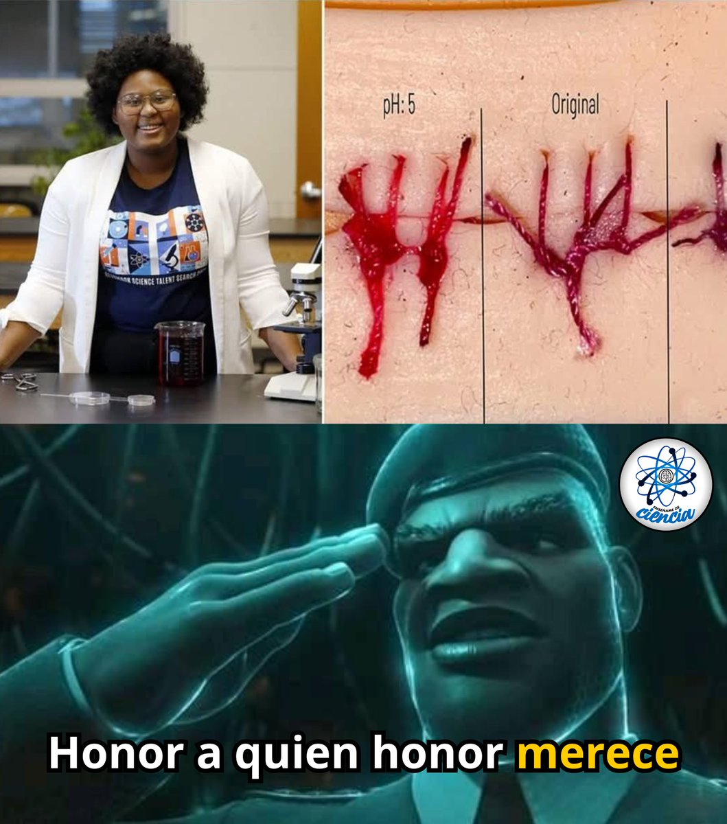 🧵🔬 Con solo 17 años, la joven estudiante Dasia Taylor llamó la atención del mundo científico con una idea tan simple como brillante: suturas capaces de cambiar de color para alertar sobre posibles infecciones.

Su proyecto se basa en un principio real de la biología: cuando una