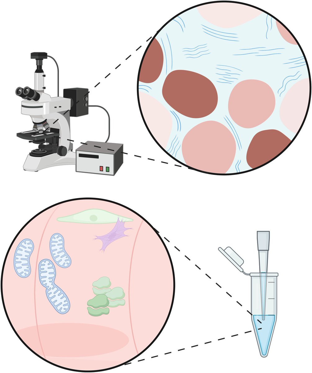 What happens at a molecular level in spastic #cerebralpalsy? This narrative review dives into the microscopic muscle changes that impair growth and function in children
buff.ly/nnT7Qri
