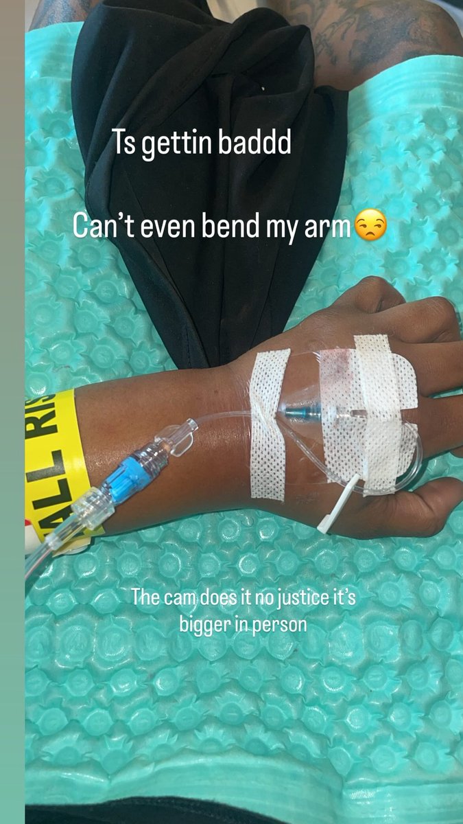 BABYFACE_SKYA's tweet photo. I told the nurse I was allergic to tape and he didn’t listen. Now my hand and arm is swollen, red and itchy. The camera does it no justice, it’s bigger in person. Came in for Sickle and leaving like this.🤦🏾‍♀️ #sicklecellwarrior #Hospital #foryou https://t.co/7ieP9dzXND