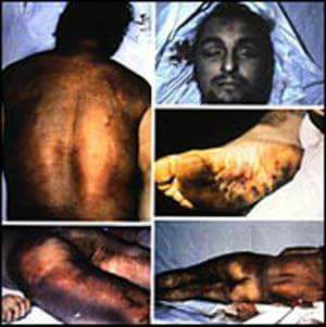 Tal día como hoy, pero de 1981, Joseba Arregi moría en el Hospital Penitenciario de Carabanchel tras ser torturado durante nueve días por la Policía Nacional en la Dirección General de Seguridad.

#Efemérides 
#MemoriaHistórica 
#Tortura