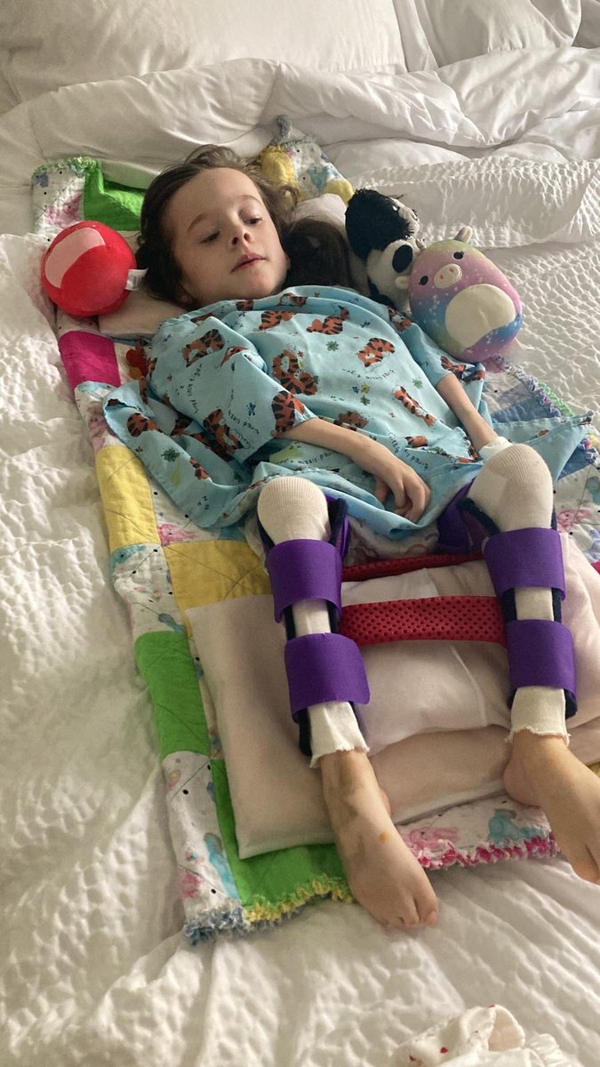 We had to travel to America to get her hips and leg surgery done . She was 7 before she could sit . Left on a wait list for 4 years here in Ireland 
No one should have to endure this .