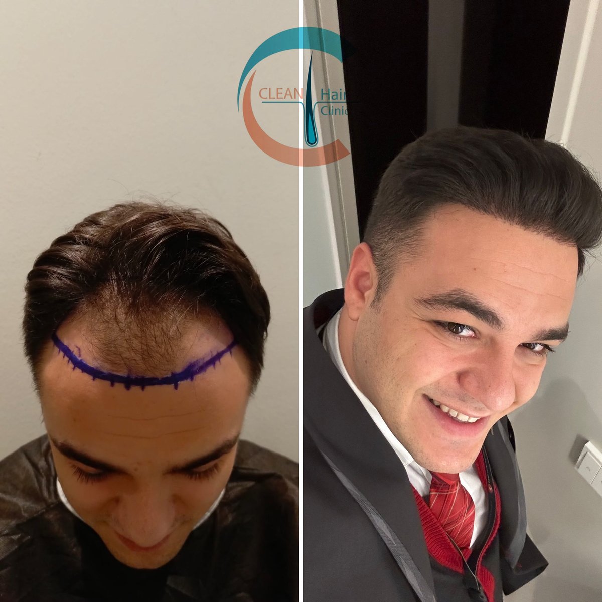 hair_clean's tweet photo. https://t.co/Q6aX7oOnRs