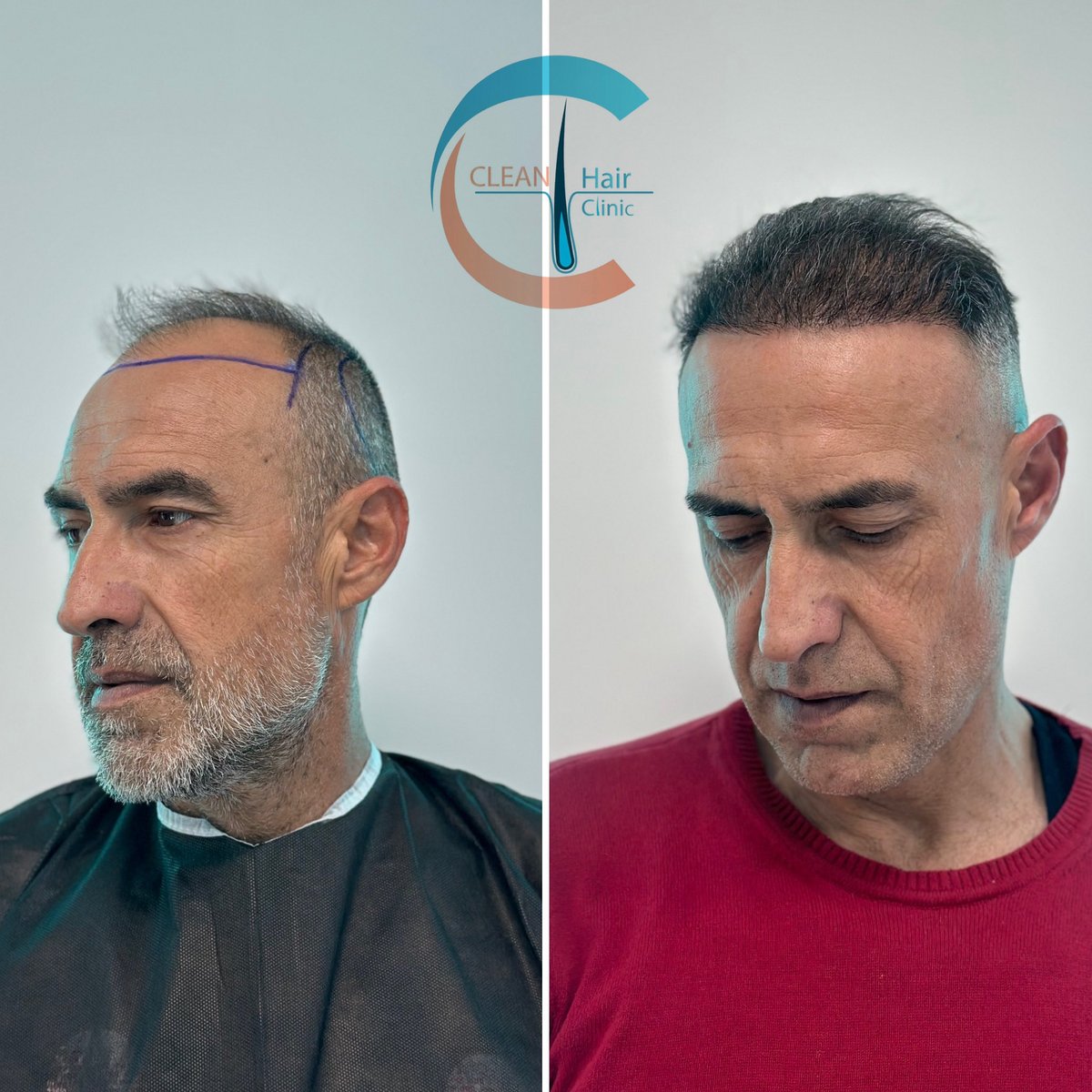 hair_clean's tweet photo. https://t.co/Bck2DHYBYm