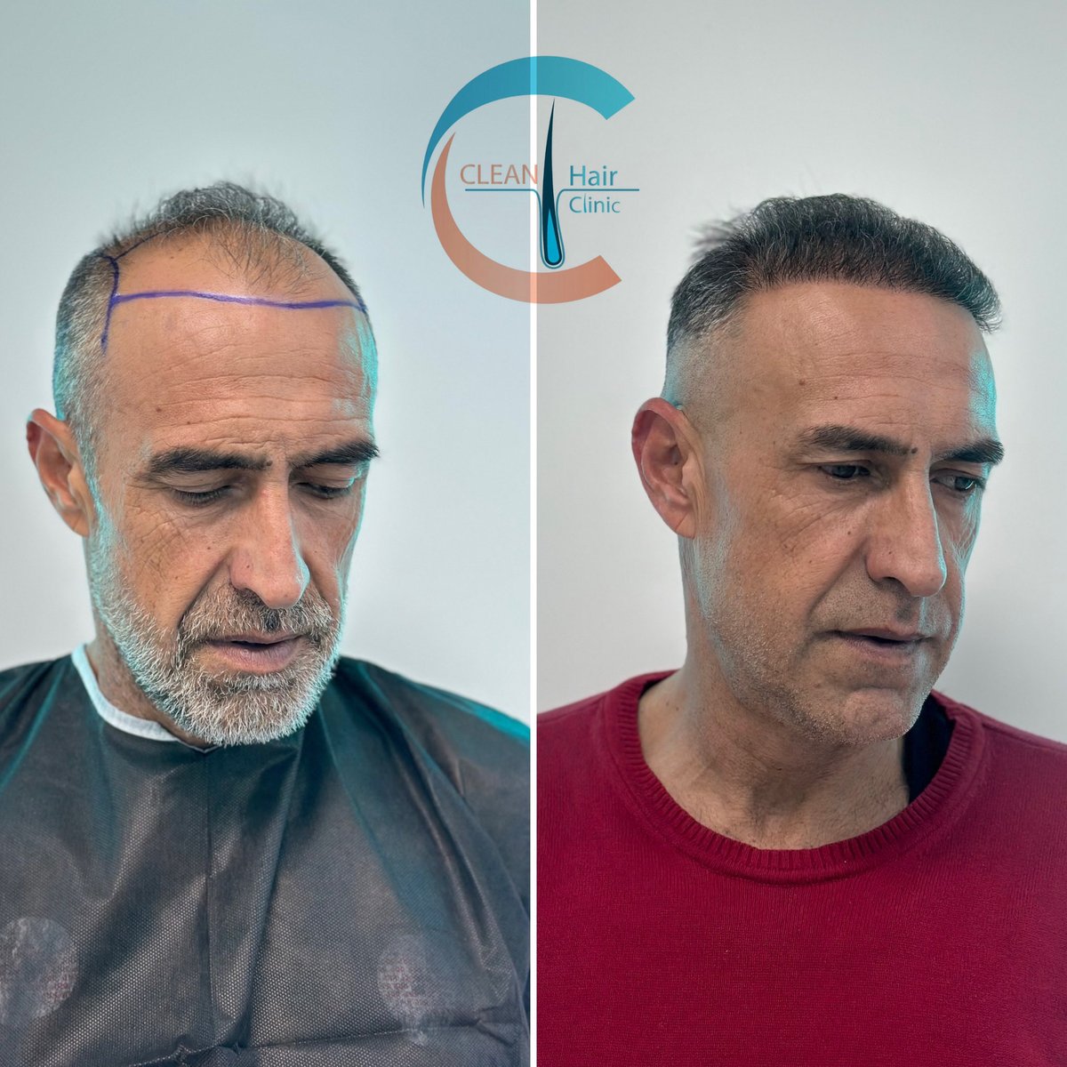 hair_clean's tweet photo. https://t.co/Bck2DHYBYm
