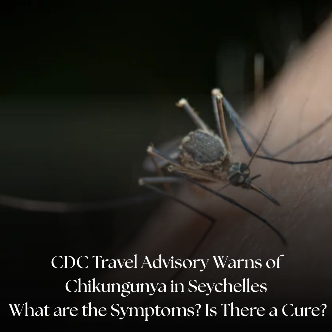 IBTimesUK's tweet image. Travellers advised to take precautions as chikungunya spreads across Seychelles

#CDC #Chikungunya #Health #Seychelles

Read More: ibtimes.co.uk/cdc-travel-adv…