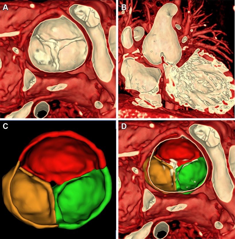 Quomi8's tweet photo. New 4D MRI technology lets doctors see children’s heart defects in motion, improving diagnosis and surgical planning.
Read more on https://t.co/UIY4SVxSWK
#quomi #PediatricCardiology #4DMRI #HeartHealth #MedicalInnovation #CongenitalHeartDefects #Radiology #MedicalImaging https://t.co/scF1OsFQ9Z