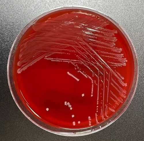 MicrobioSoc's tweet photo. Lactococcus garvieae prosthetic aortic and mitral valve endocarditis with multiple embolic complications: a case report. Published Open Access and fee-free in ACMI using a Publish and Read agreement: https://t.co/KGhjKifwQ0 #AccessMicro  #PublishandRead https://t.co/iSdjMHVExz