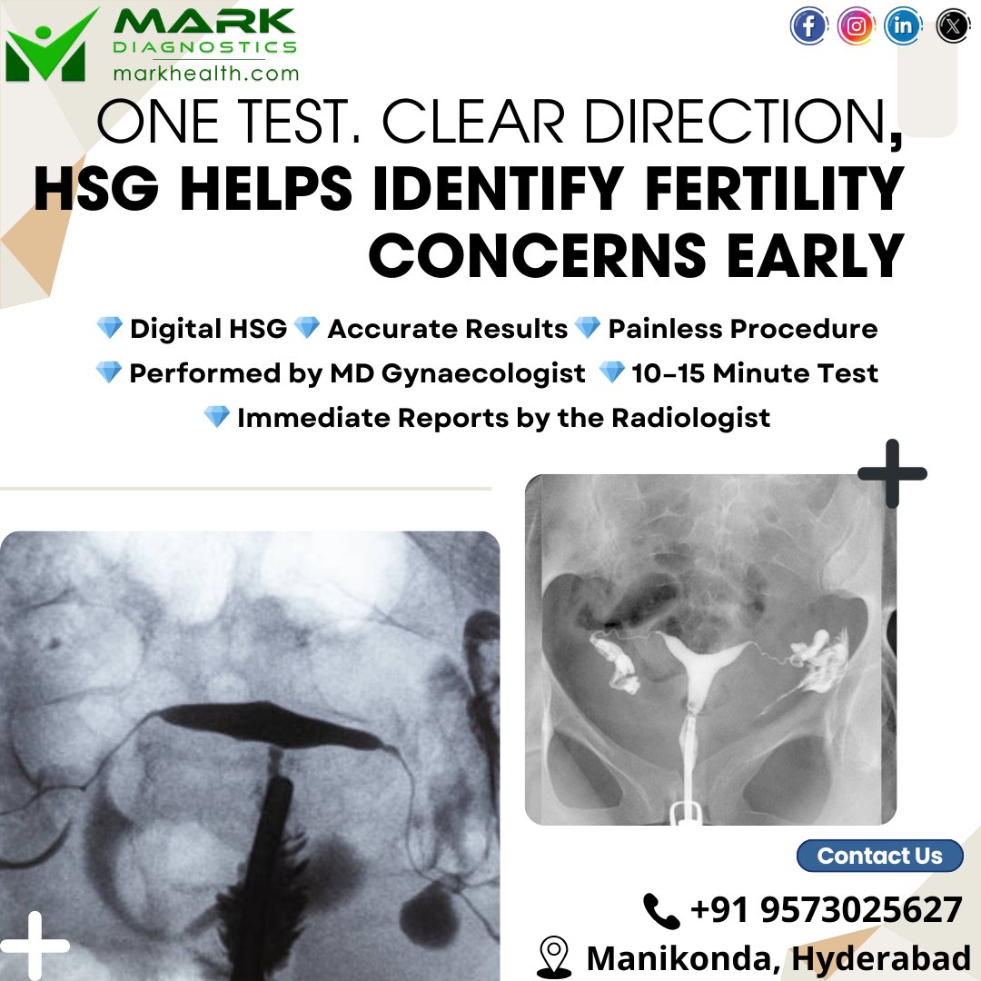 MarkDiagnostics's tweet image. HSG Test – Fast &amp;amp; accurate 
Digital Hysterosalpingogram
🔹 Painless
🔹 MD Gynaecologist
🔹 10–15 min test
📄 Immediate radiologist report
📍 Manikonda, Hyderabad
📞 +91 9573025627
#HSGTest #DigitalHSG #FertilityCare #WomenHealth #InfertilitySupport #Markdiagnostics