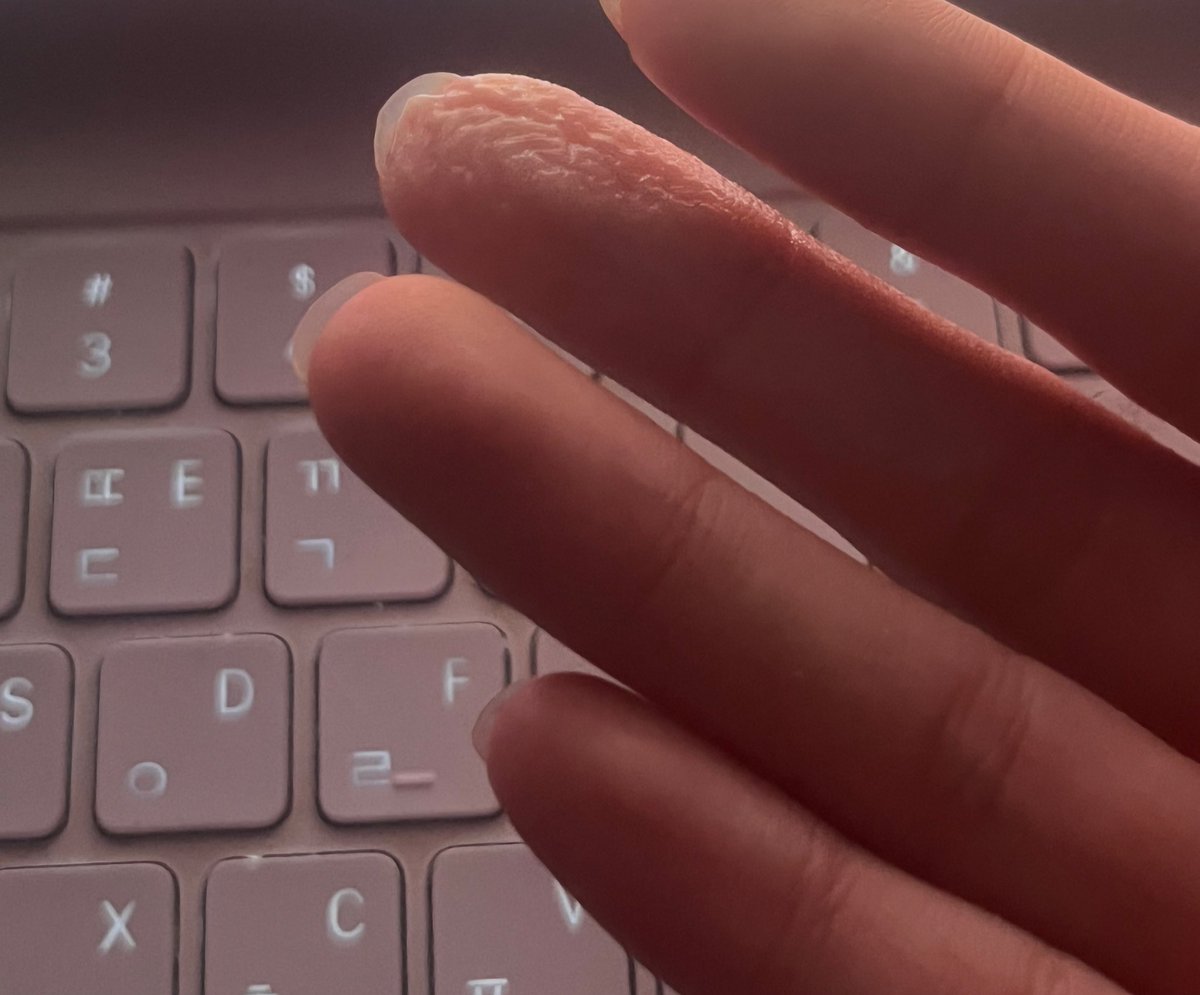 어딜 넣은건지 정확하게 알 수 있음...