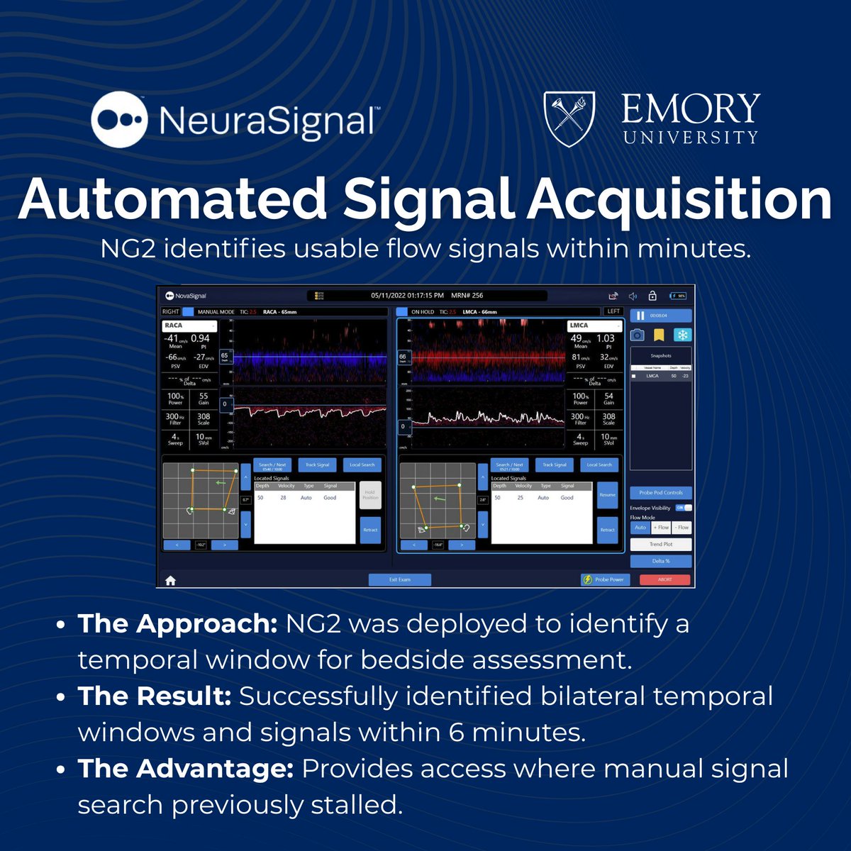 NeuraSignal tweet media