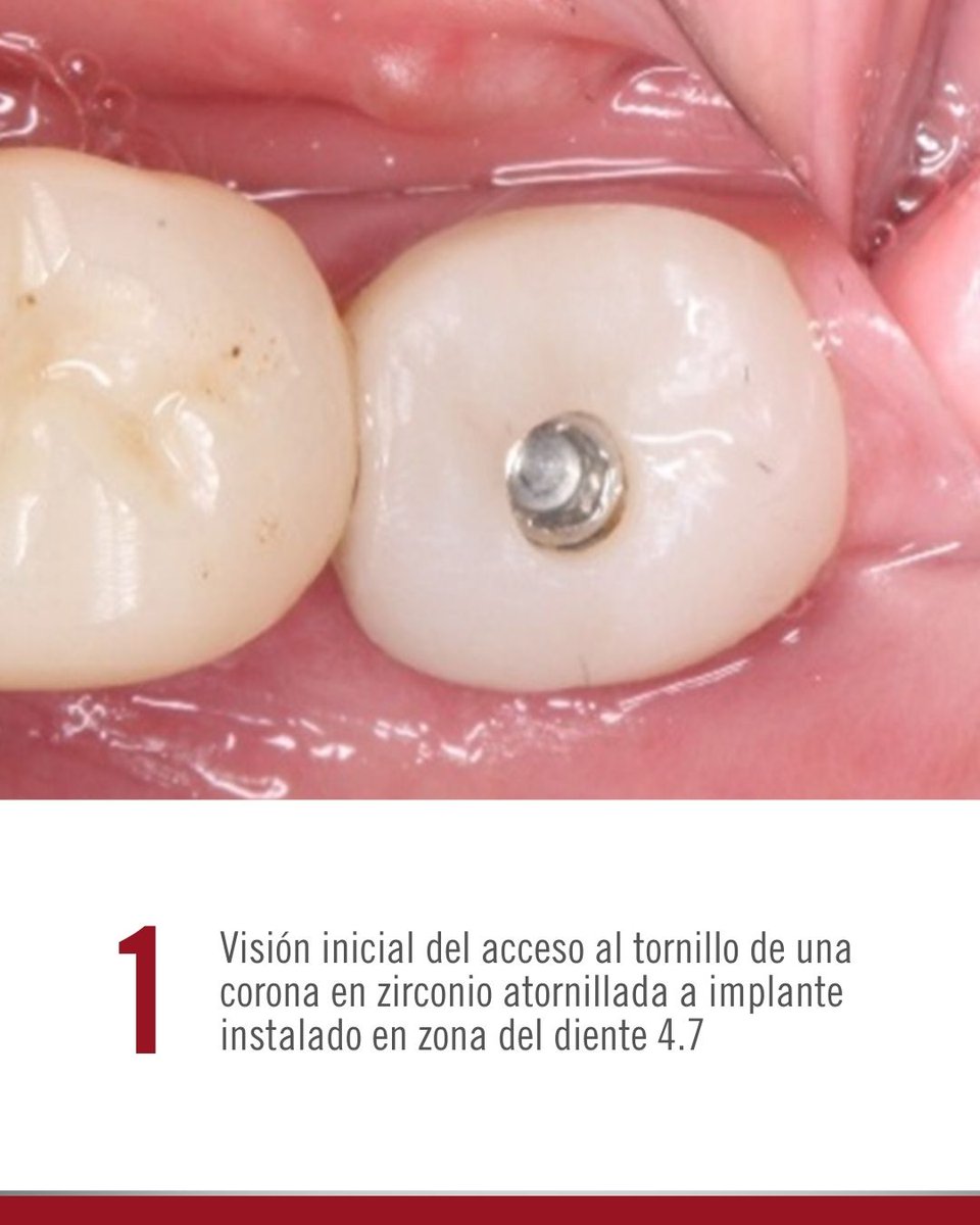 Kulzer México tweet media