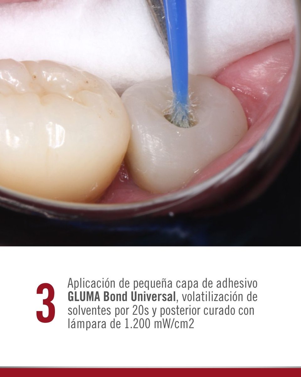 Kulzer México tweet media