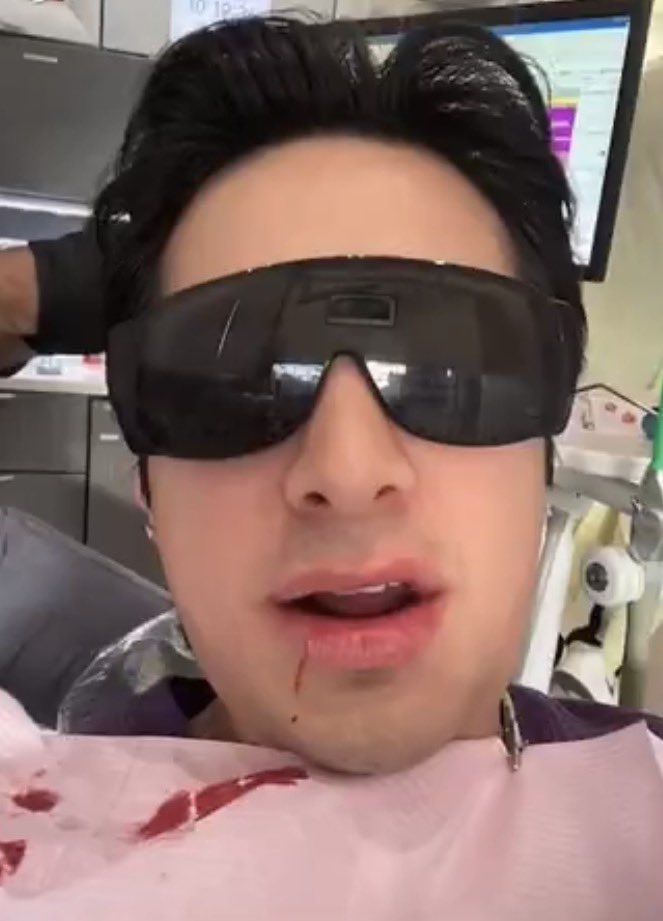 matchalesbiana's tweet image. to celebrate hudson’s bday i got my wisdom teeth removed just like him . i’m #dedicated