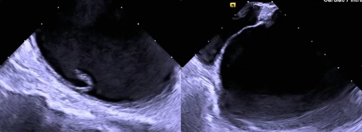 Heart Rhythm Case Reports tweet media
