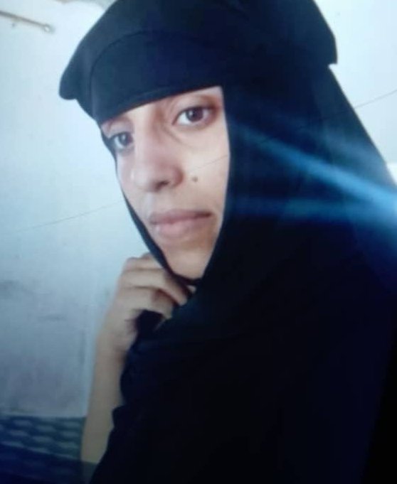 ايش تسمون هاذي النقطة السوداء الي في وجهي