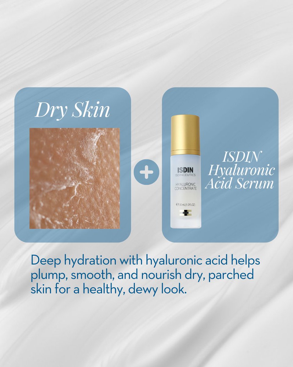 FabFacesAC's tweet photo. Match your concerns with the ideal products and treatments for a complexion worth falling for. Whatever your skin type, we have the right solutions to keep your skin healthy, glowing, and happy ✨

Visit Aesthetic Center to find your perfect skin match today! https://t.co/hoLY68gHLX