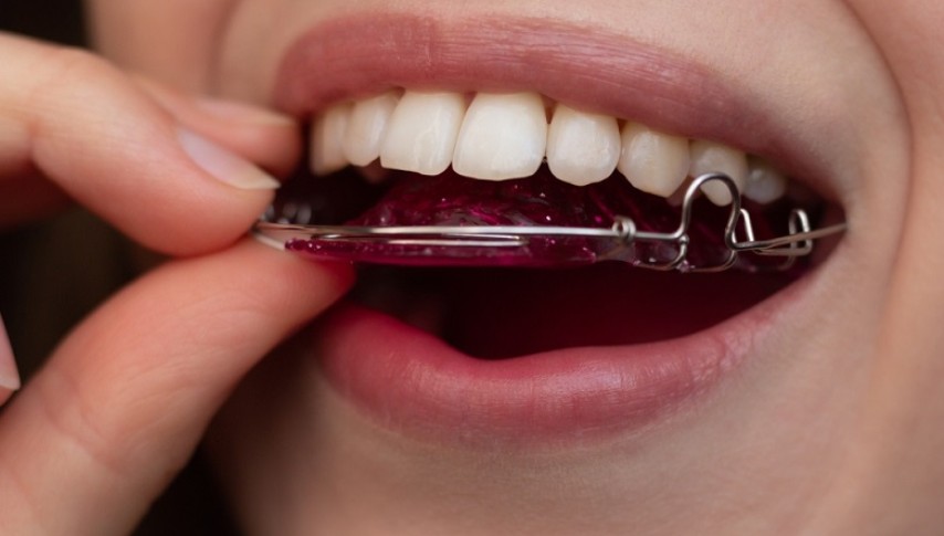 Vip Tooth VIP Smiles Orthodontics (@orthodonti36260) / Posts / X