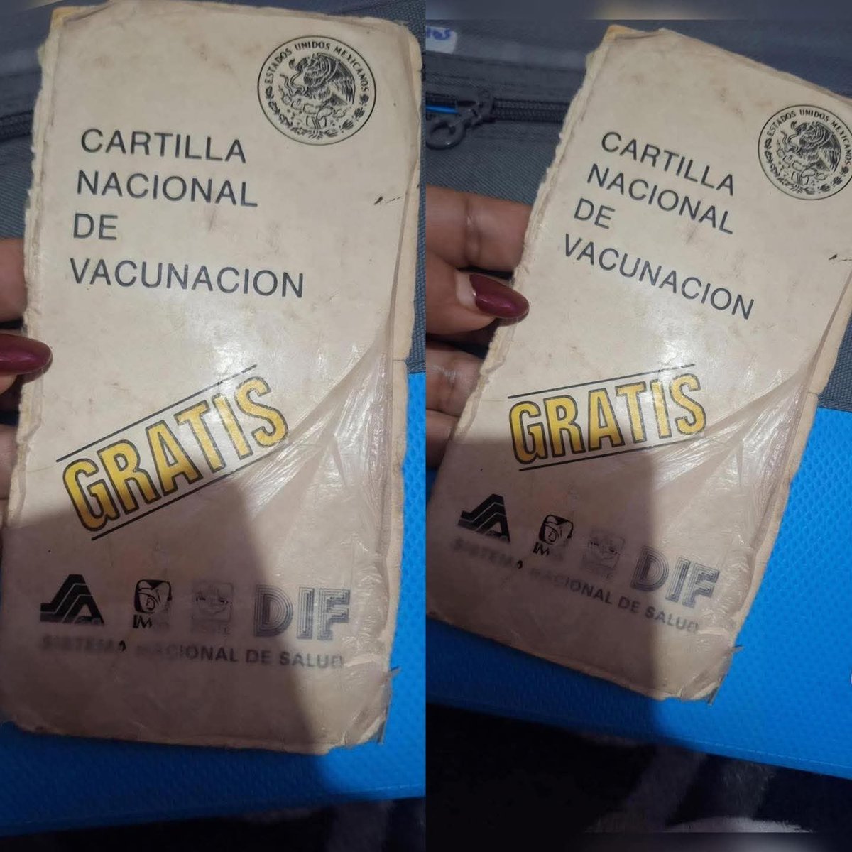 Si tuviste una de estas el sarampión no te va hacer nada.