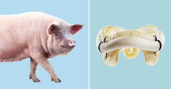 iamquadrich's tweet photo. Medically, pig parts have saved many human lives — pig heart valves are used in human transplants, and pig-derived insulin treated diabetes until the 1980s. https://t.co/cGBXjsD6b4