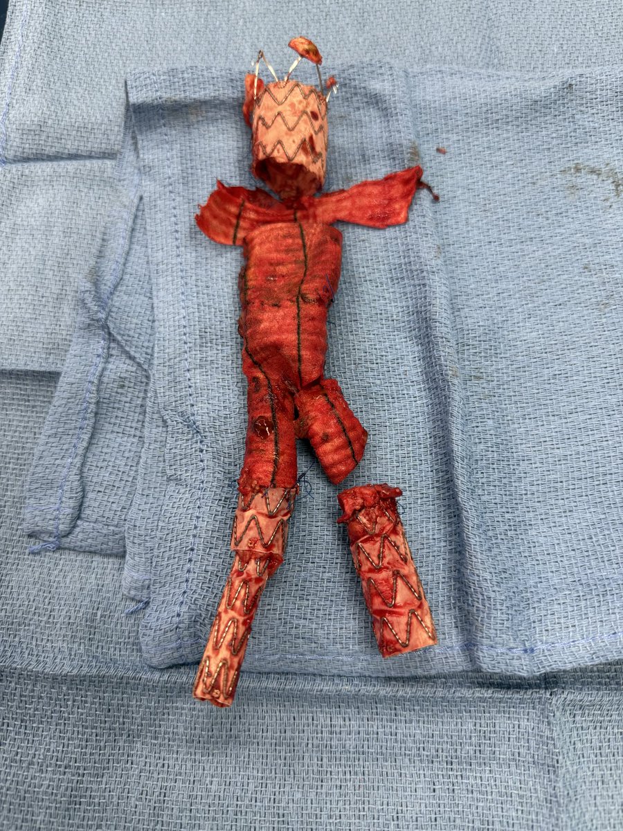 farkomd's tweet photo. They tried endo. They tried open.
In the end, we did surgery
All out. Radical debridement. Visceral/Renal Reconstruction. Cultures obtained.
#InTheBucket https://t.co/jpNA69exRS