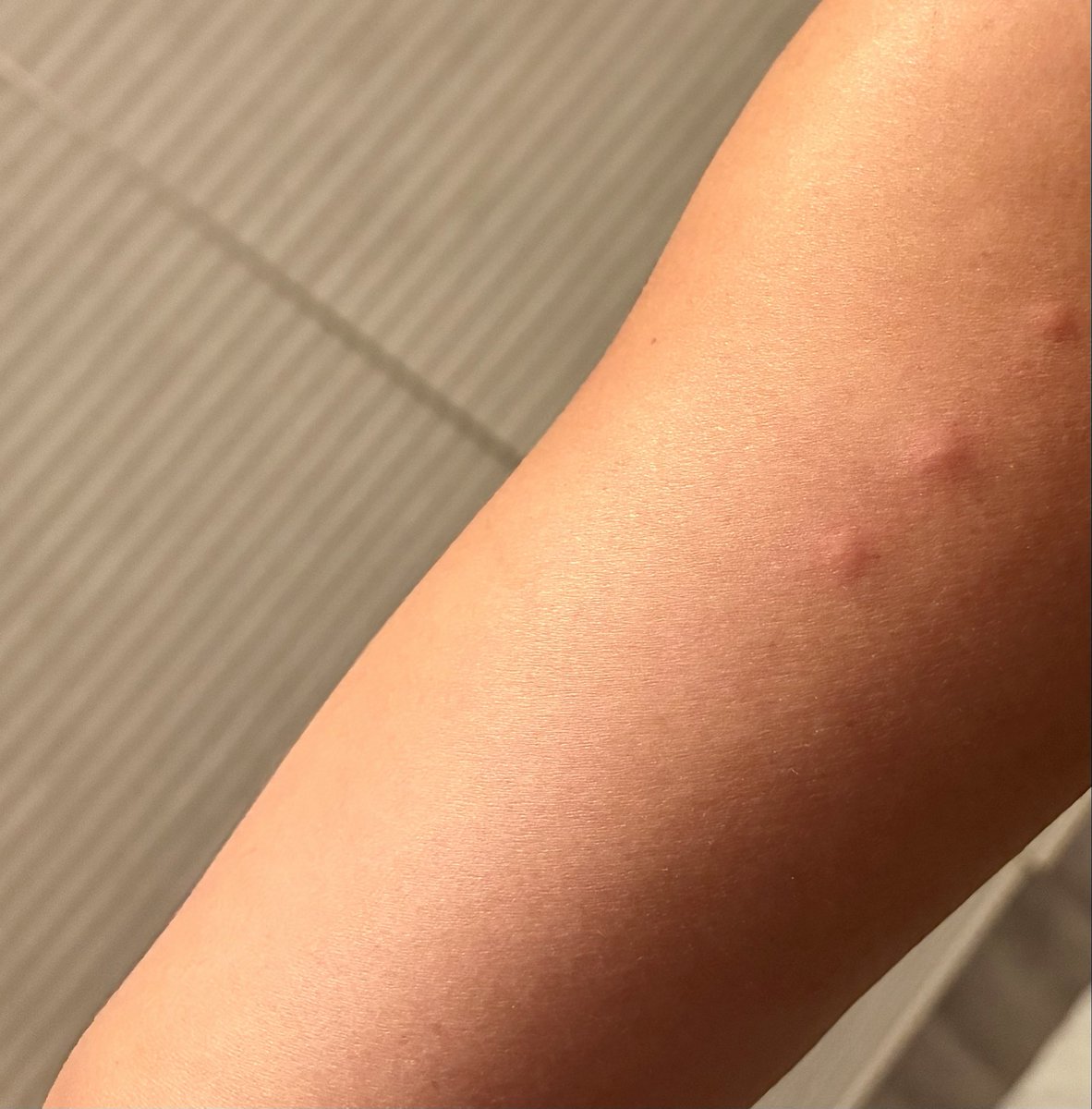 mardilgras's tweet photo. When you realize your bug bite formation looks familiar https://t.co/D0VhYMn1gj