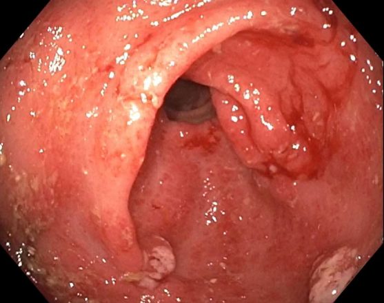 Tom Tielleman, MD tweet media