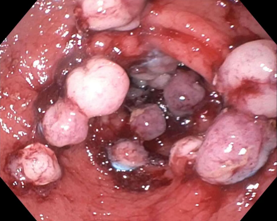 Tom Tielleman, MD tweet media