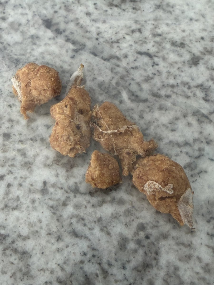 Buffalo, NY SkyWatcher tweet media