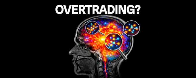 📈 A Practical Way to Eliminate Overtrading

Overtrading is rarely a discipline problem. It’s a structure problem.

When your rules are vague, your brain fills the gaps. The chart “looks good.” The move “feels strong.” You convince yourself it fits. That’s where most bad trades