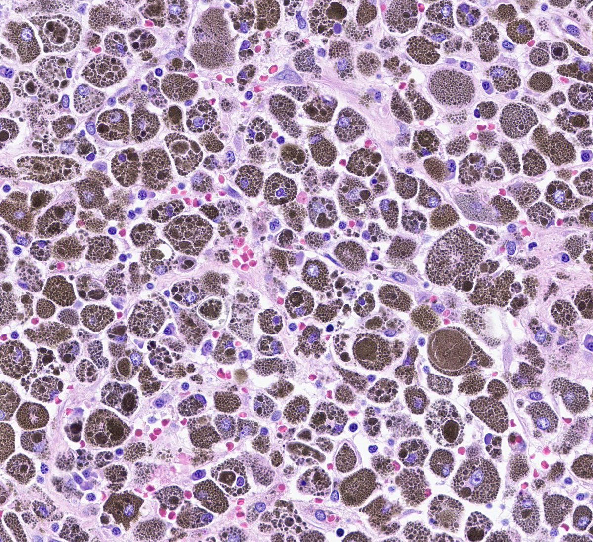 Craig Horbinski tweet media