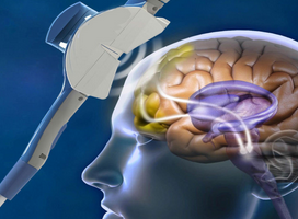 neuroconsciente's tweet photo. La investigación, liderada por Margarita Moreno Montoya, actúa directamente sobre la corteza frontal lo cual reduce la compulsividad. Un avance clave para mejorar el bienestar y la inclusión social. https://t.co/bjGkytr9sl