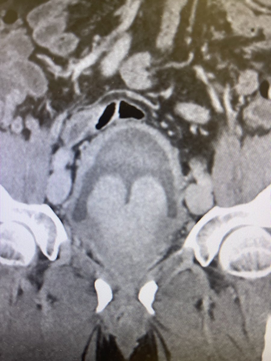 Perry Xu tweet media