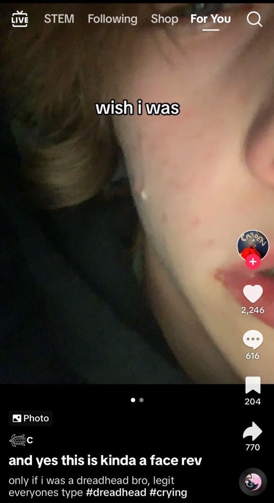 KingLohengramm's tweet image. #dreadhead #crying #biologicallydefeated