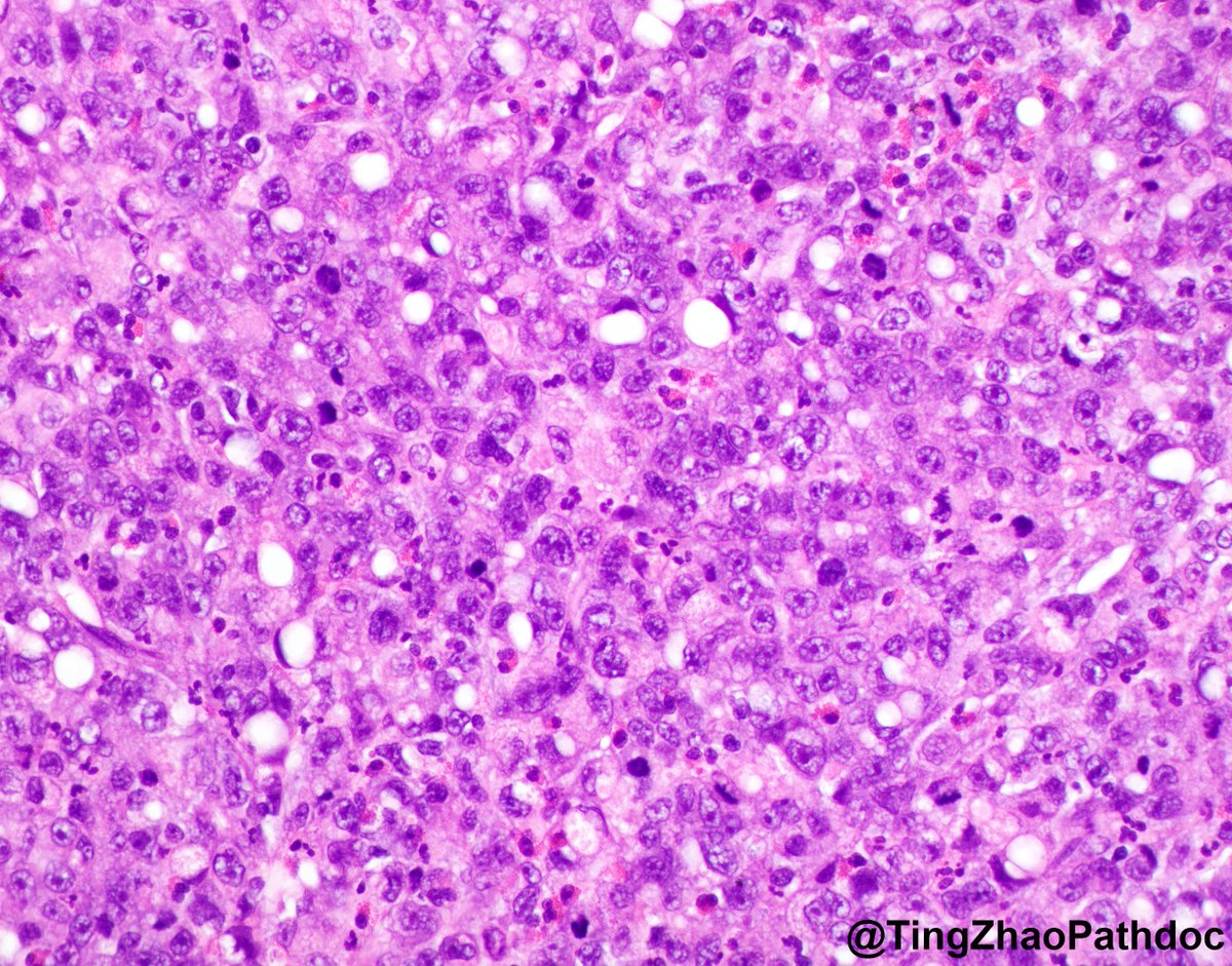 Ting Zhao, MD tweet media