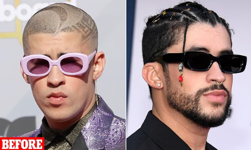 lukethereporter's tweet photo. Bad Bunny had quite the glow up 👀

I spoke to doctors about what might have fueled his transformation - from weight loss to jaw work

Full story: https://t.co/UVlt39ZdZt https://t.co/ywpFWJZUmI