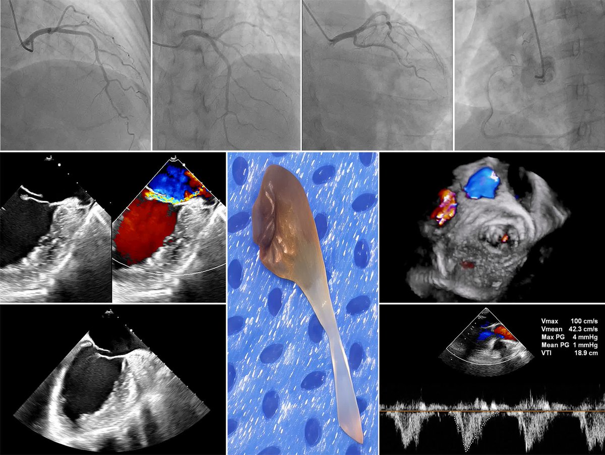 CircImaging tweet media