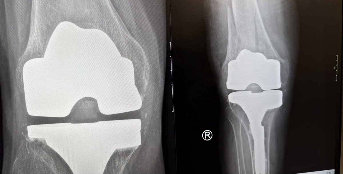 SP Orthopaedics tweet media