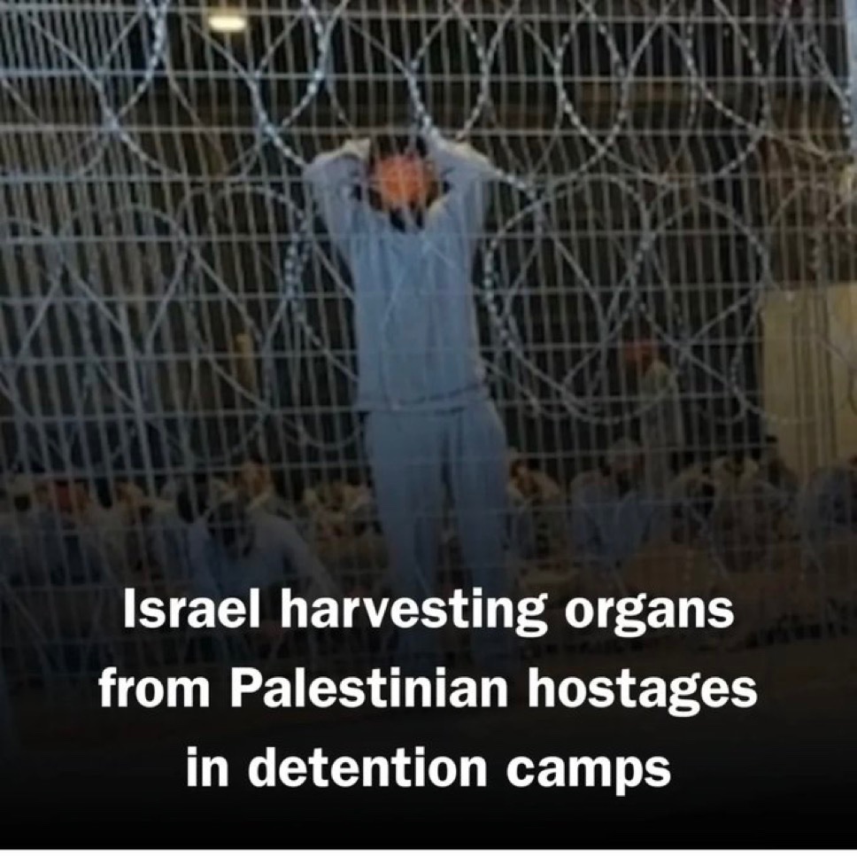 Zionists are DISGUSTING! 🤮