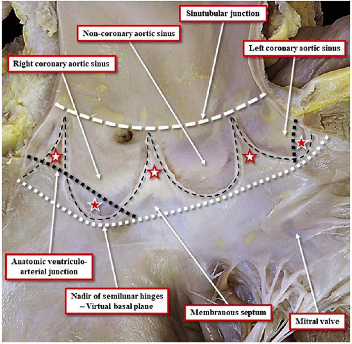 HeartRhythm tweet media