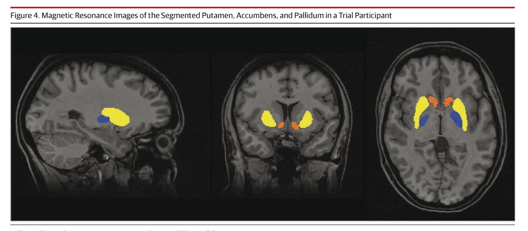 JAMA Neurology tweet media