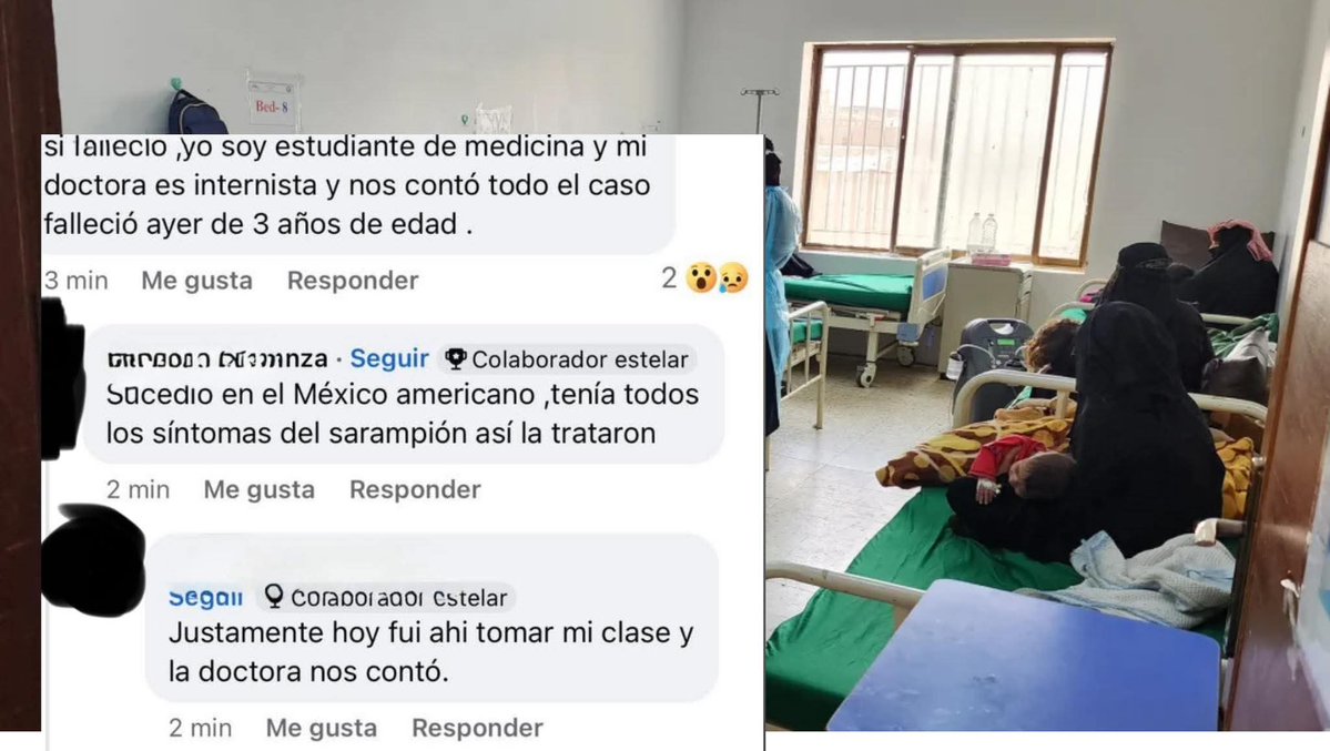 🚨ACABA DE Morir, NIÑO 3 AÑOS CON SINTOMAS DE SARAMPION EN NUEVO LAREDO; NO LO QUIEREN HACER PUBLICO🚨😱

Solo se pasa el dato,ya anda el sarampion en Nuevo Laredo cuiden a sus hijos &amp; tambien en Laredo Tx cuidense,eso se va hacer mas grande.
