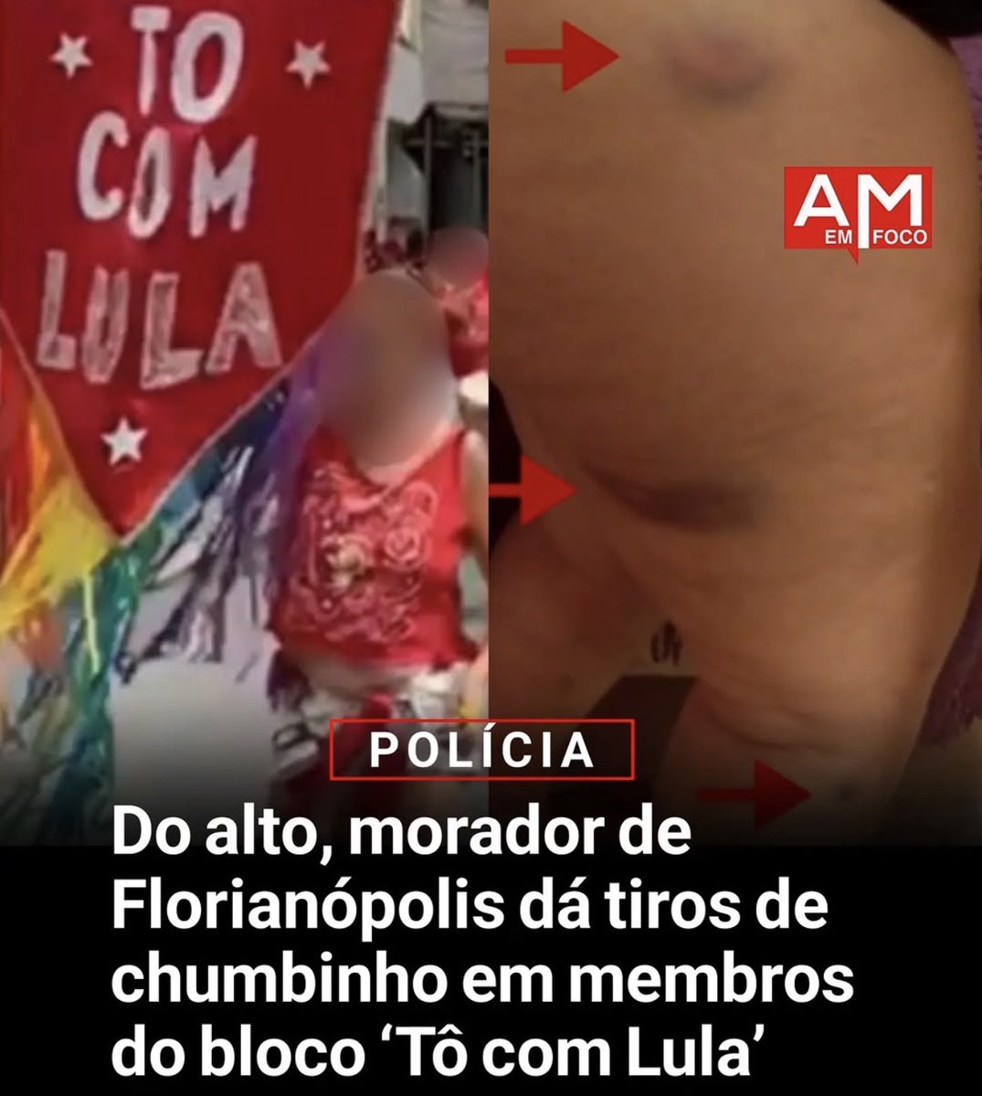 Felipe Leme tweet media