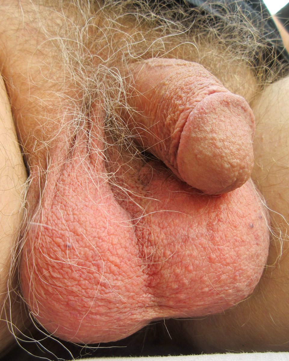 Splattter tweet media