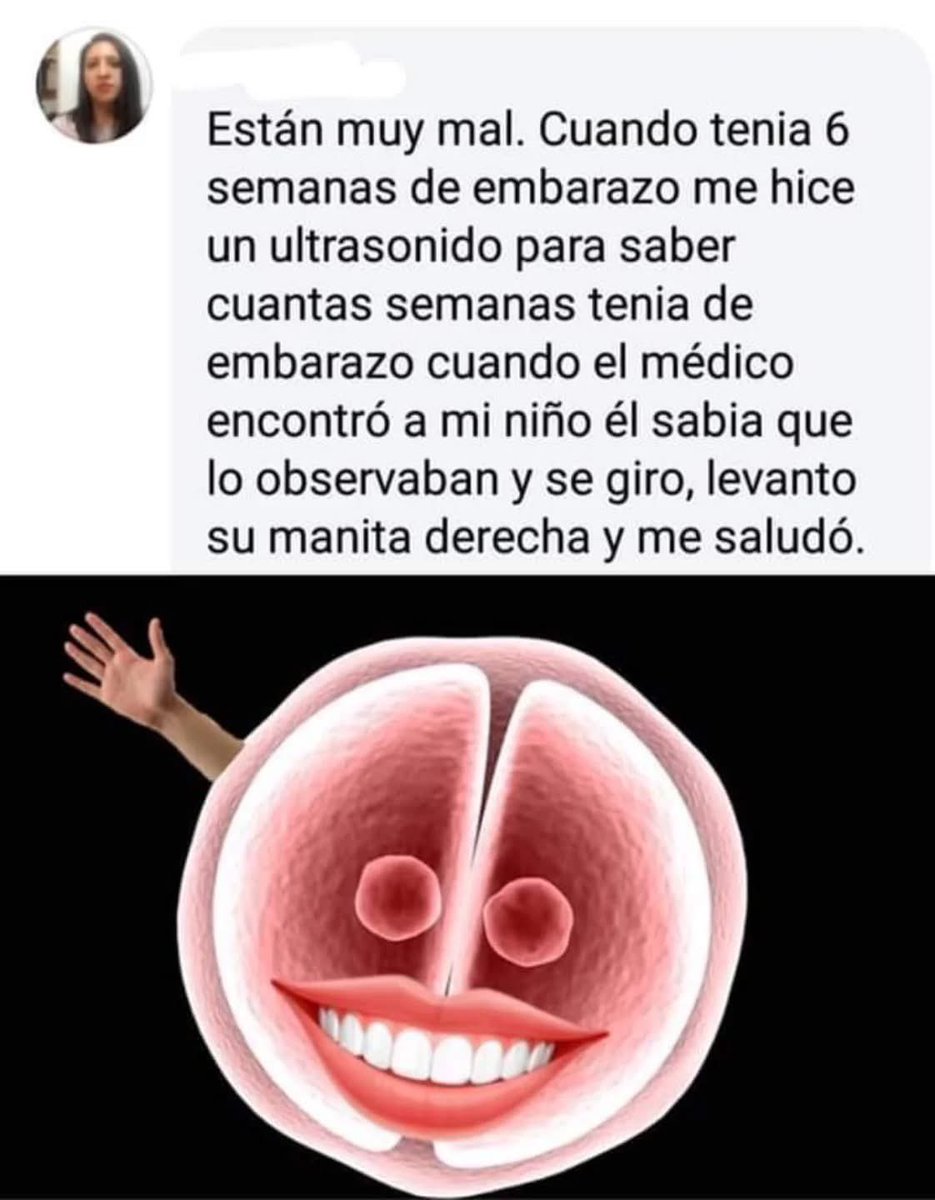 Authentic Tlacuache 🤘🦡🏳️‍🌈 tweet media