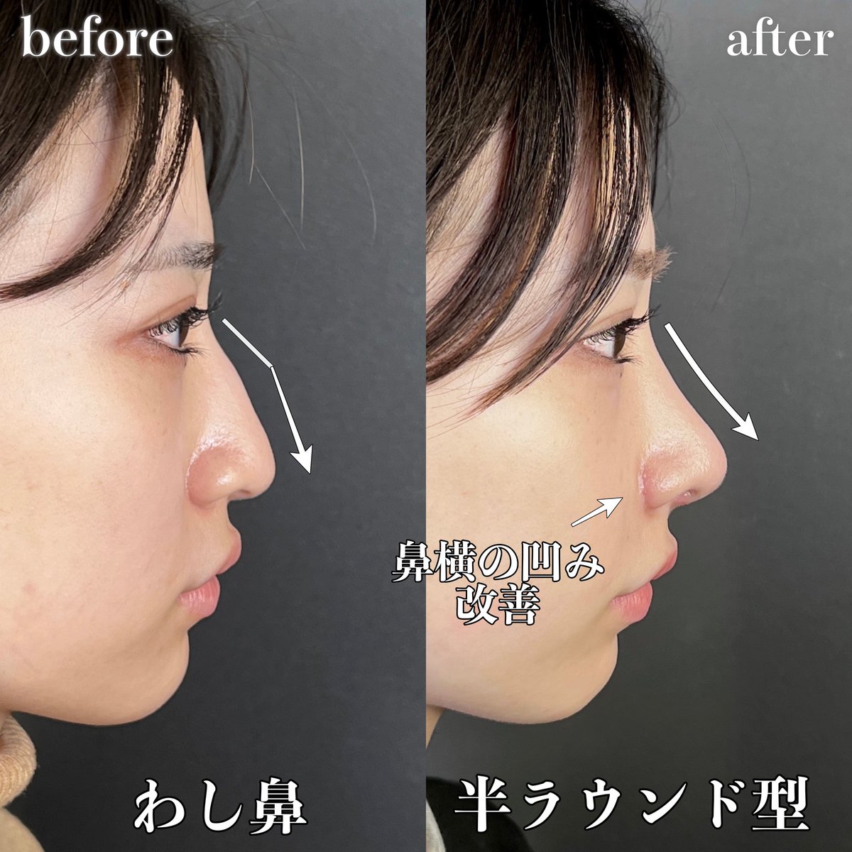 忘れ鼻の美容外科医 Dr小池 tweet media