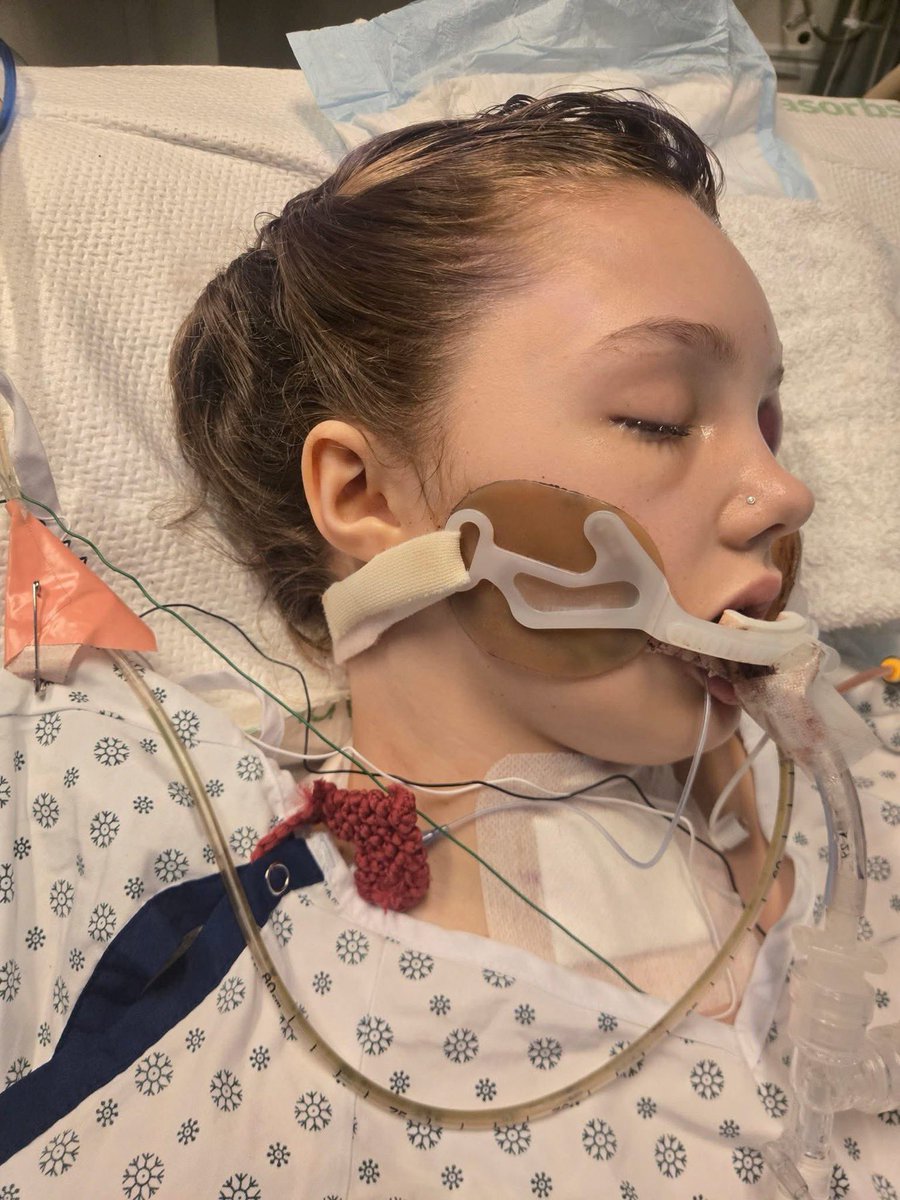 MattWallace888's tweet photo. Continue to pray for Maya she is still holding on by the grace of God https://t.co/S90ikUb0uP