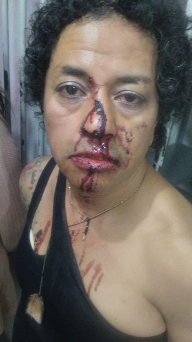 amets_mex's tweet image. @AlessandraRdlv mientras tanto tú mandas reprimir a trabajadoras seuxales y mujeres trans! Exigimos la libertad y reparación de las compañeras detenidas @lleca_org @ClaraBrugadaM @craviotocesar todos ustedes son la misma 💩 no importa su partido!