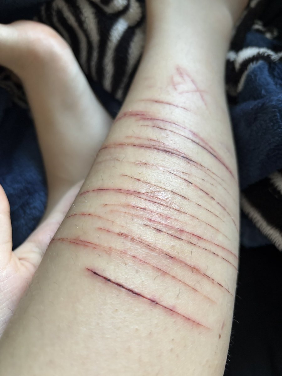 atleast  i hae a heart