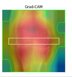 affanned399's tweet photo. #Algorithm #TensorFlow #Keras #PyTorch #SupervisedLearning #UnsupervisedLearning #AIResearch #MLResearch #AIEngineer #AIInnovation #ModelInterpretability #ExplainableAI #XAI #FeatureVisualization #GradCAM #IntegratedGradients #SmoothGrad #HeatmapVisualization https://t.co/ChW03gm1na